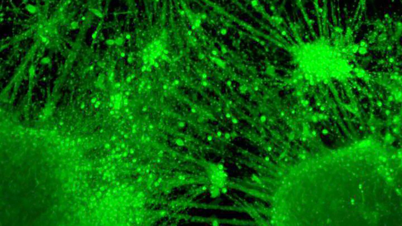 Organoidy kory mózgowej to sztucznie hodowane, trójwymiarowe kultury komórek nerwowych wykorzystywane w badaniach już od pewnego czasu (fot. Takahashi et. al / Stem Cell Reports)