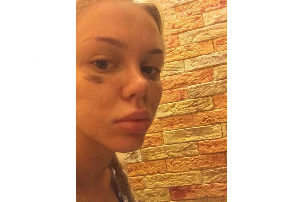 Катя Самбука осылай есінен танып қалады. Катя Самбука осылай есінен танып қалады.