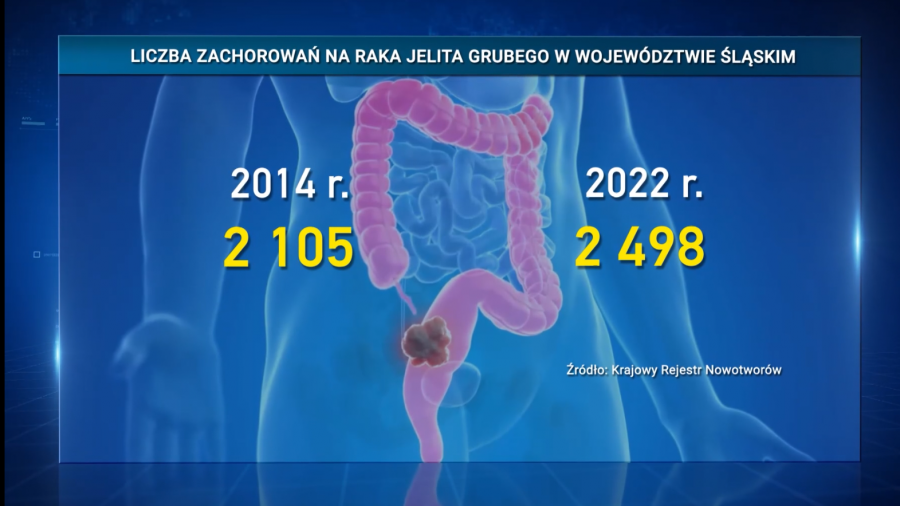 Liczba zachorowań na raka jelita grubego w woj. śląskim 