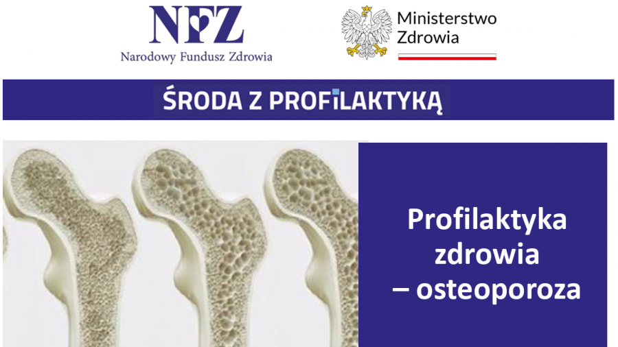 Osteobus zaparkuje przy Sali Obsługi Klientów NFZ. Bezpłatne badania