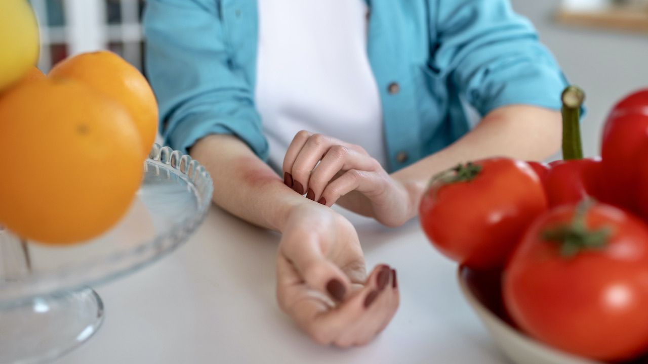 Alergia pokarmowa dotyka ok. 8 proc. dzieci i 10 proc. dorosłych w USA (fot. Shutterstock/Dmytro Zinkevych) Alergia pokarmowa dotyka ok. 8 proc. dzieci i 10 proc. dorosłych w USA (fot. Shutterstock/Dmytro Zinkevych)