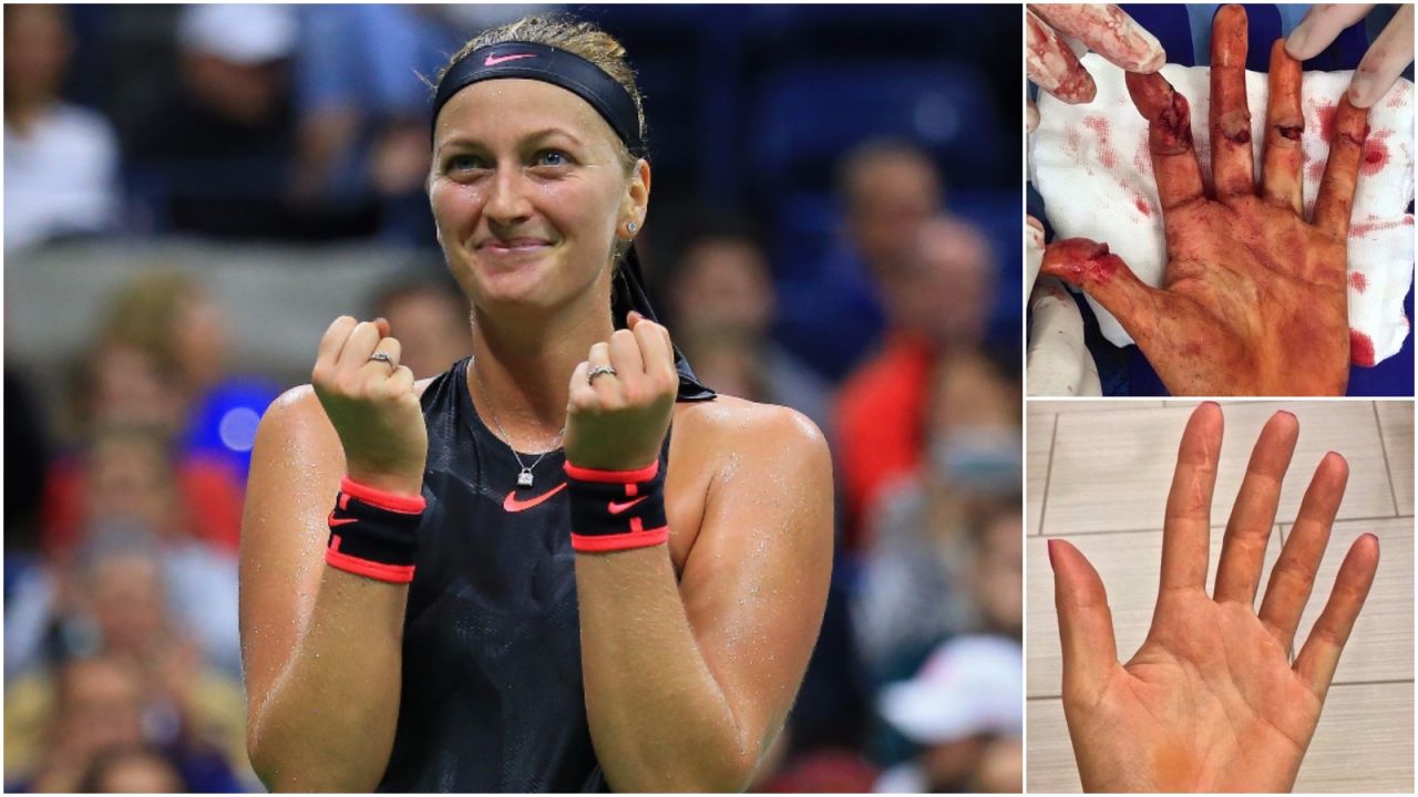 Boli od samego patrzenia. Kvitova znów zachwyca